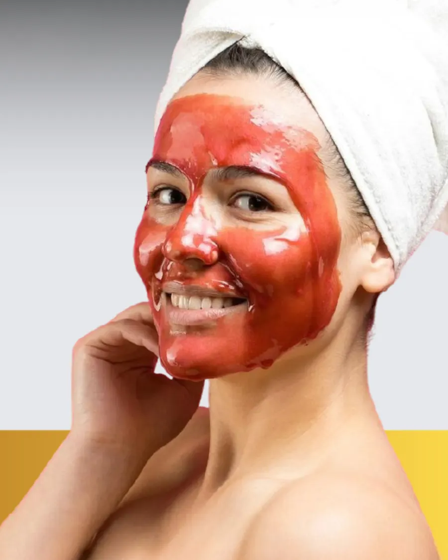Vampire Facial at Cinch Clinics